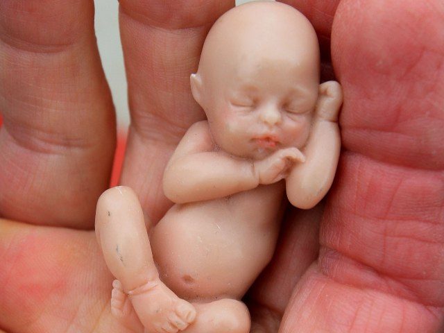 Georgia Supreme Court Reinstates Heartbeat Law Overturned By Liberal Judge